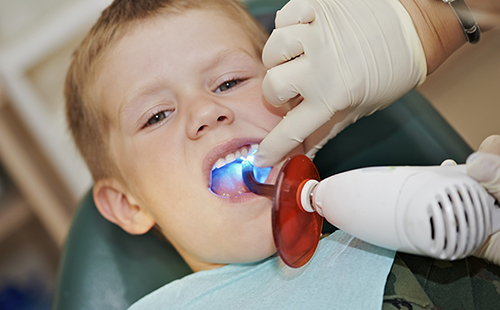 Photo of child at the dentist having a cavity filled.