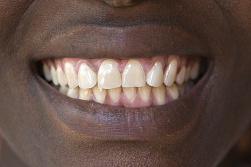 A photo of straight, natural teeth